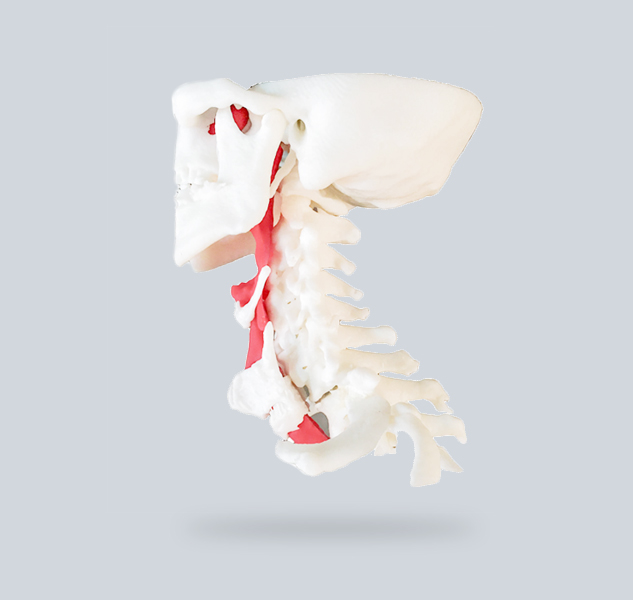 3D печатная модель позвоночника и дыхательной трубки